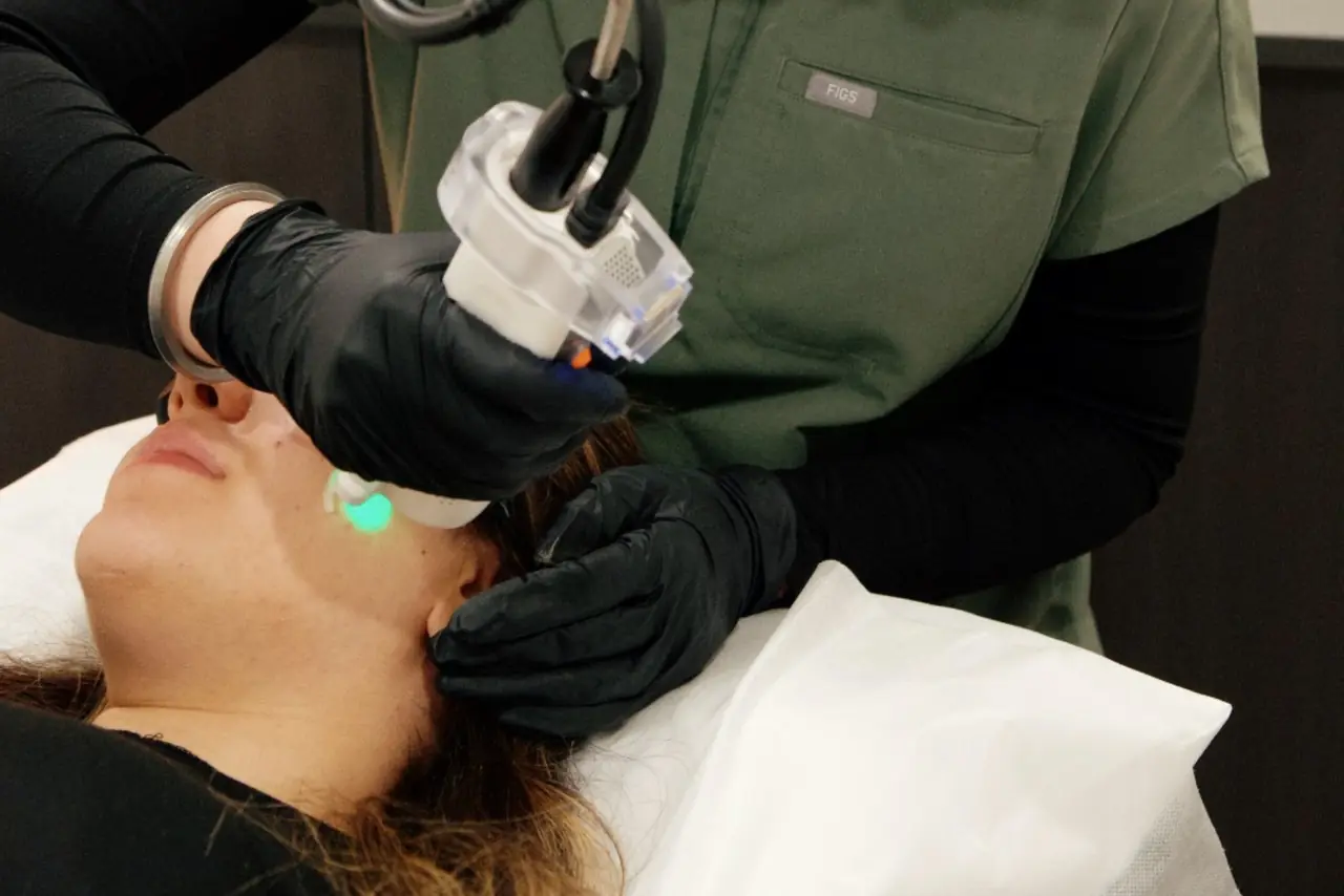 A laser treatment at Skinholic