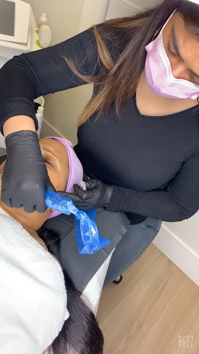 A practitioner performing microneedling on a client’s face