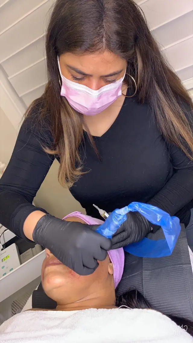 A practitioner performing microneedling on a client’s face