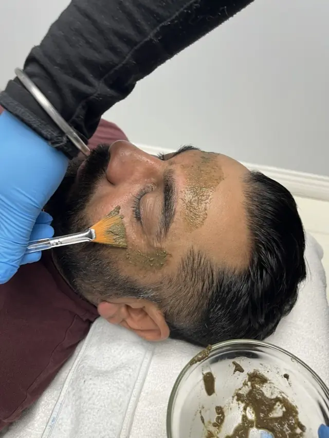A practitioner brushing a depigmentation mask onto a client’s face