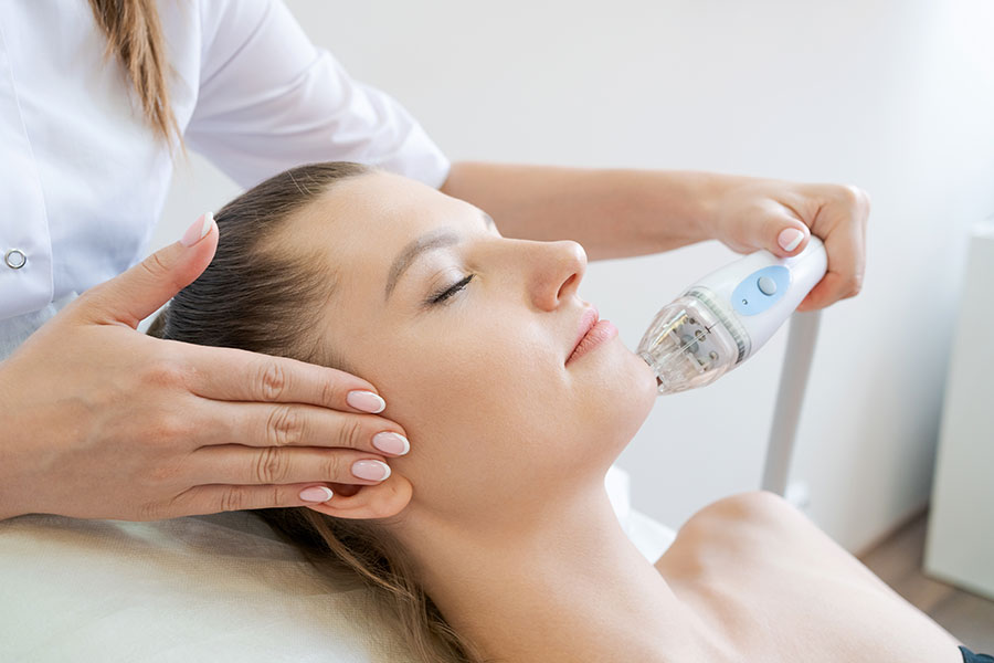 RF Microneedling Services
