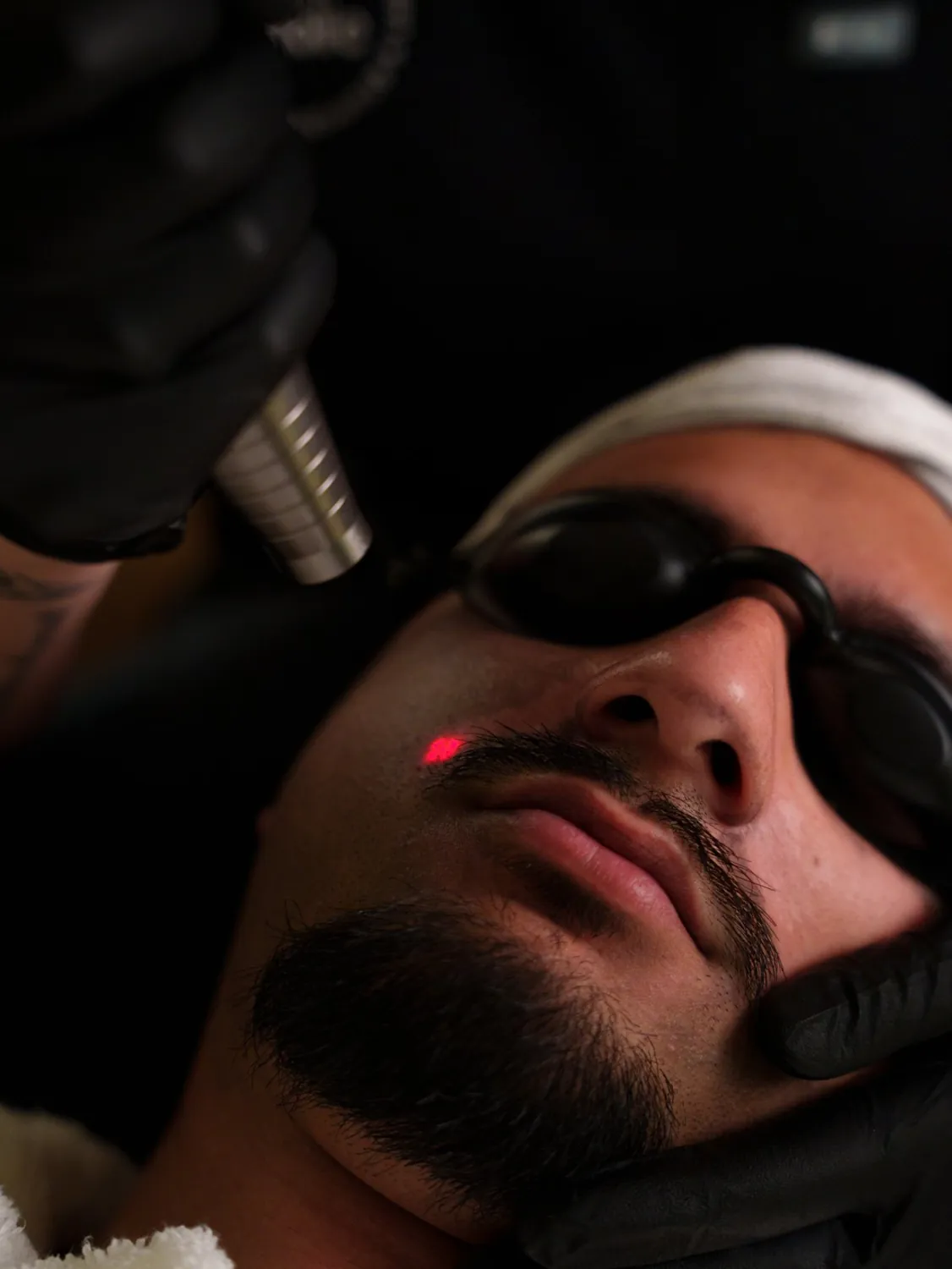 A laser facial in progress, client wearing protective eyewear